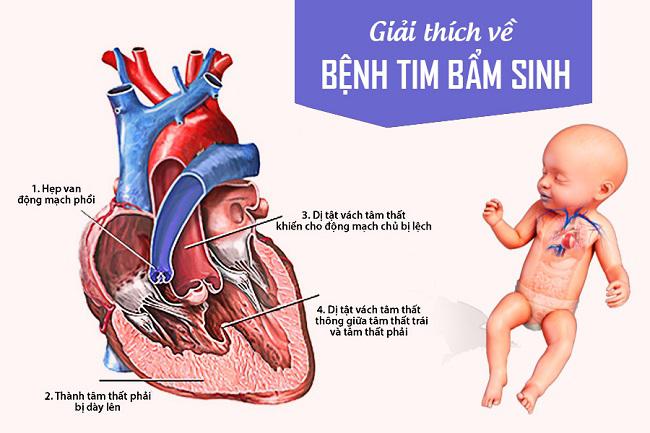 TPHCM: Kỳ tích thông van tim cho bào thai bị dị tật tim bẩm sinh nặng